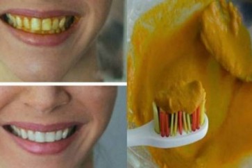 احصلوا على أسنان بيضاء وبشكل فوري باستخدام مكون واحد فقط!